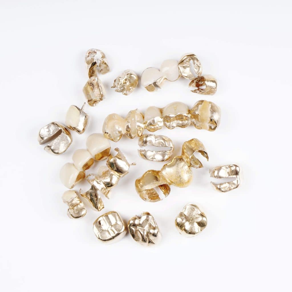 Dental Scrap Gold and Silver